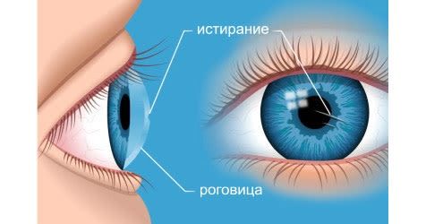 Чебоксарская клиника «Микрохирургия глаза» в Дрожжаном